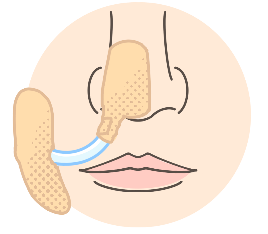 経鼻経管栄養(鼻・口元・固定テープ)のイラスト